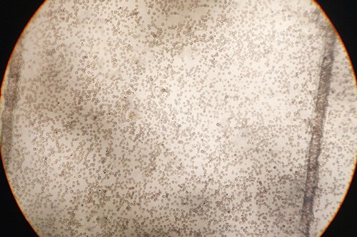 Cocci hen worm egg count